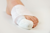 When Is Toe Surgery Needed?