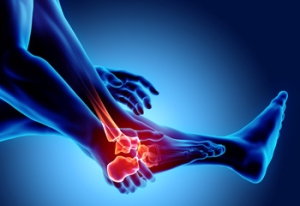Causes of Foot Stress Fractures