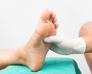 Charcot Foot Is a Rare but Serious Foot Condition