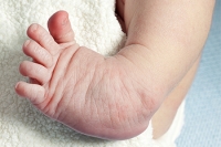 Little Known Facts About Clubfoot